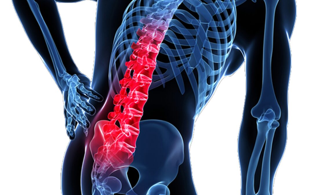 Relieve and Conquer: How Physiotherapy Transforms Sciatica Pain