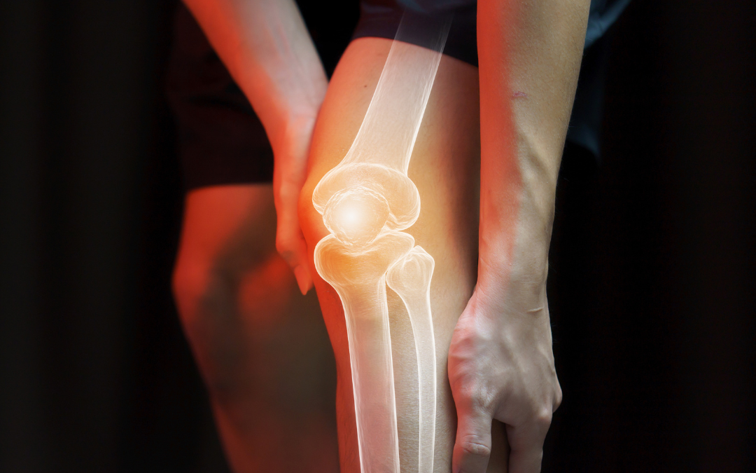 Understanding Arthritis: Pain Management and Relief